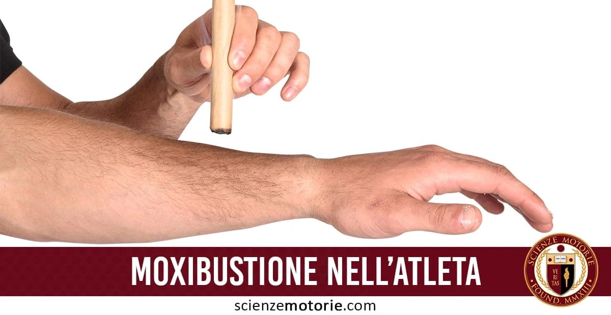 Nell'immagine, una persona sta applicando la moxibustione su un braccio. La moxibustione è una pratica della medicina tradizionale cinese che utilizza il calore generato dalla combustione dell'erba di artemisia su specifici punti del corpo. Il testo nell'immagine dice "MOXIBUSTIONE NELL'ATLETA", con il logo e il sito "scienzemotorie.com" visibili in basso.