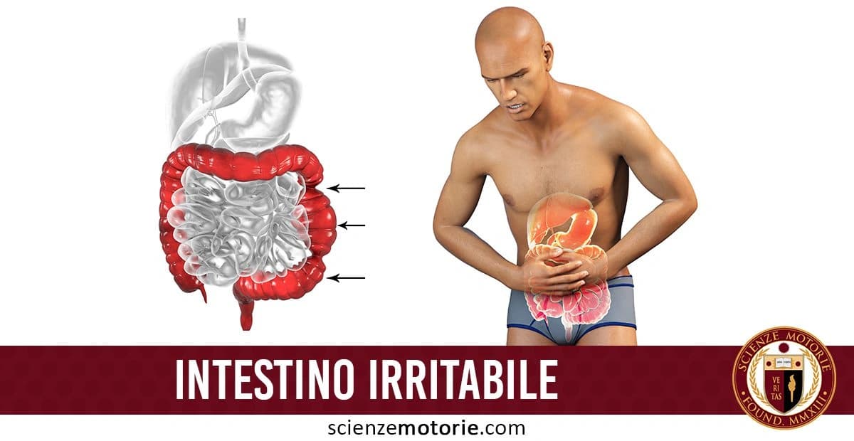Illustrazione dell’intestino con il colon evidenziato in rosso e figura umana che mostra dolore addominale, con testo “Intestino Irritabile” e logo Scienze Motorie.