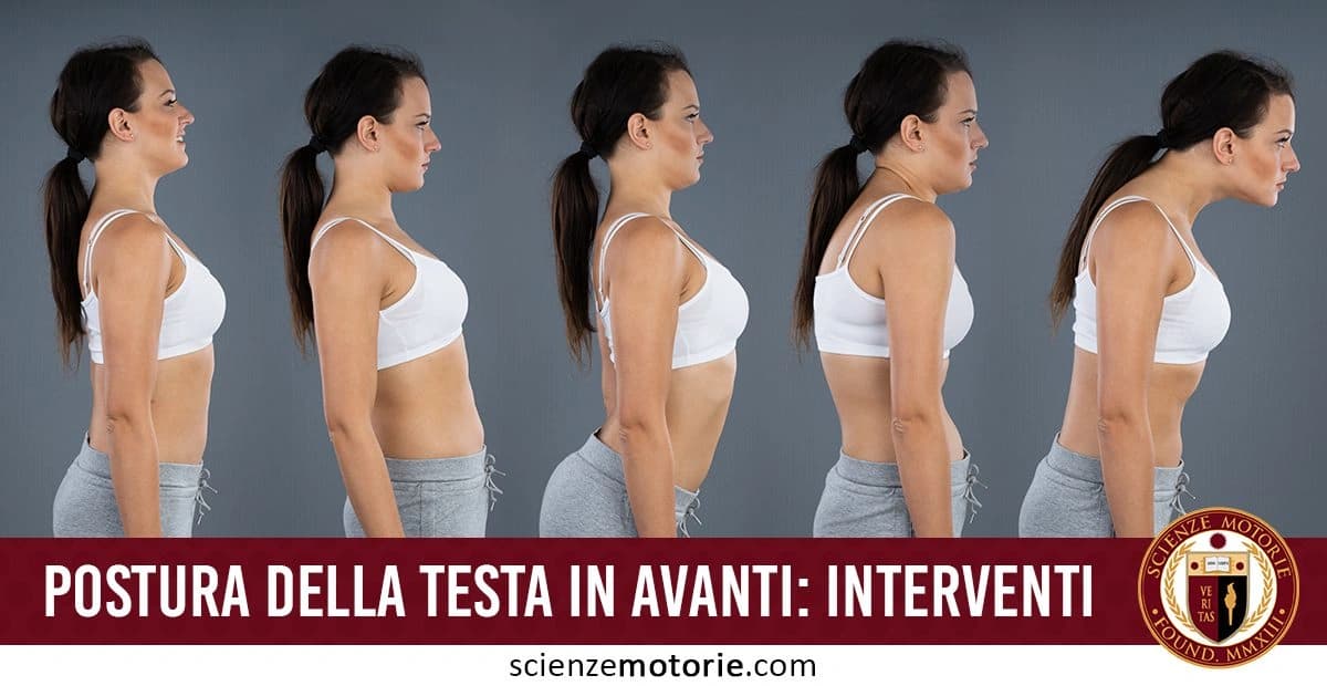 Progressione posturale di una donna di profilo che mostra diversi gradi di testa in avanti, dalla postura corretta a quella scorretta, con testo "Postura della testa in avanti: interventi" e logo Scienze Motorie.