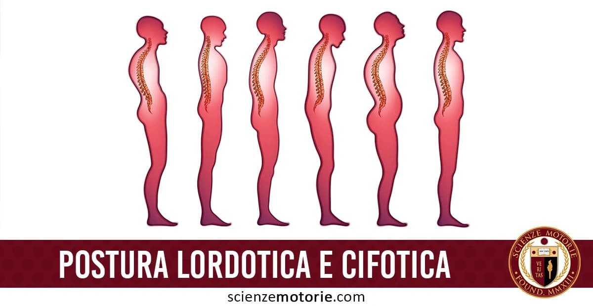 L'immagine mostra diverse silhouette di profili umani che rappresentano vari tipi di postura della colonna vertebrale, evidenziando le differenze tra lordosi (curvatura in avanti) e cifosi (curvatura indietro). La parte inferiore dell'immagine presenta il testo "POSTURA LORDOTICA E CIFOTICA", con un logo a destra di Scienze Motorie
