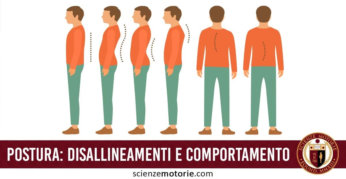 L'immagine mostra cinque illustrazioni di una persona in diverse posizioni posturali, viste di lato e da dietro. Si osserva una progressiva deviazione dalla postura corretta eretta a sinistra verso posture errate a destra, con inclinazioni e curve che indicano vari gradi di disallineamento della colonna vertebrale e del corpo. In basso, c'è il testo "POSTURA: DISALLINEAMENTI E COMPORTAMENTO" insieme al logo di scienzemotorie.com