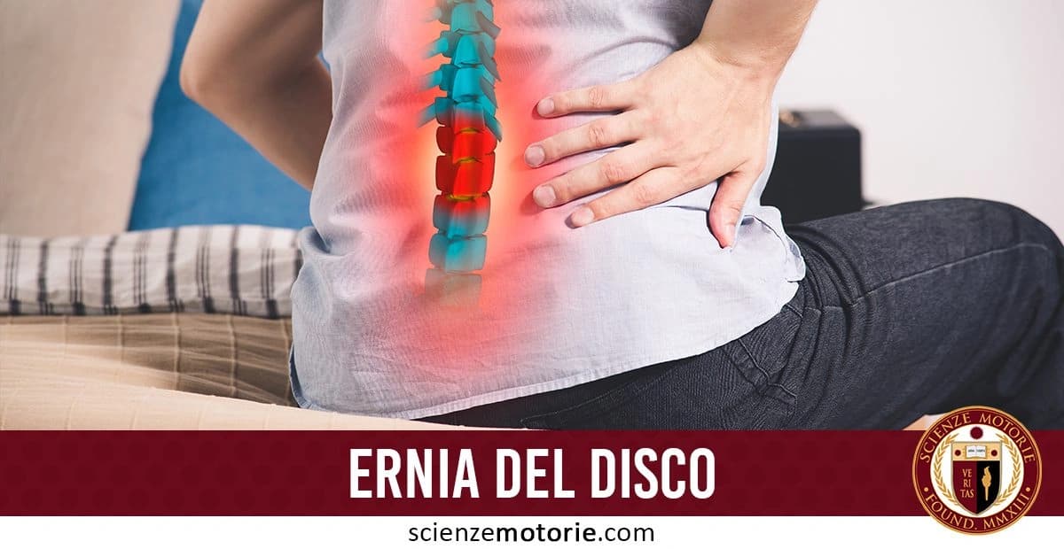 Persona seduta su un letto con una mano sulla parte bassa della schiena, accompagnata da un'illustrazione della colonna vertebrale con un'area evidenziata in rosso, indicando dolore da ernia del disco. Testo: 'ERNIA DEL DISCO' e logo di Scienze Motorie.