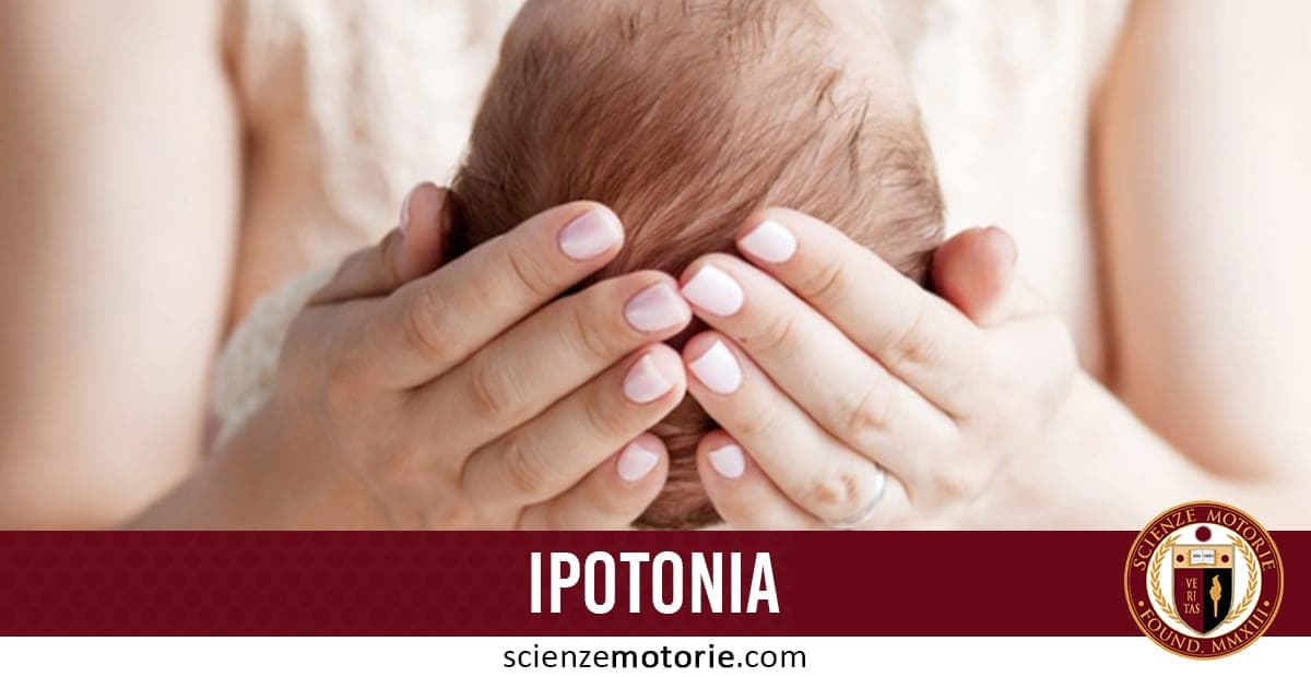 Mani di un adulto che sostengono delicatamente la testa di un neonato, con la scritta "IPOTONIA" e il logo di Scienze Motorie.