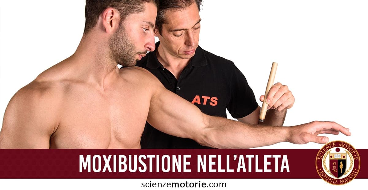 L’immagine mostra due uomini, uno a torso nudo che estende il braccio e l’altro che tiene uno strumento per la moxibustione, una tecnica terapeutica tradizionale. Lo sfondo bianco evidenzia la scena, con il testo "MOXIBUSTIONE NELL’ATLETA" su uno sfondo rosso scuro. Il logo di ScienzeMotorie.com è presente nella parte bassa dell'immagine