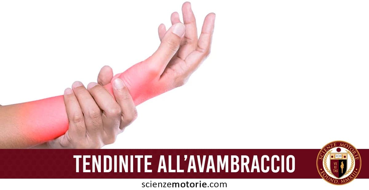Immagine illustrativa di tendinite all’avambraccio, con una persona che si tiene il braccio arrossato per il dolore. Rappresenta un comune disturbo muscolo-tendineo dovuto a sforzi ripetitivi o sovraccarichi funzionali, frequente negli sportivi e nei lavori manuali. In basso appare la scritta "tendinite all'’avambraccio" e il logo di Scienze Motorie