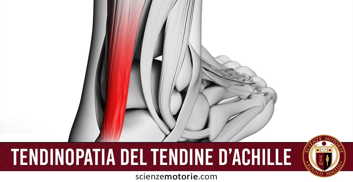Illustrazione anatomica della parte inferiore della gamba e del piede con il tendine di Achille evidenziato in rosso. In basso si legge "Tendinopatia del tendine d’Achille". Nell’angolo inferiore destro è visibile il logo di ScienzeMotorie.com.