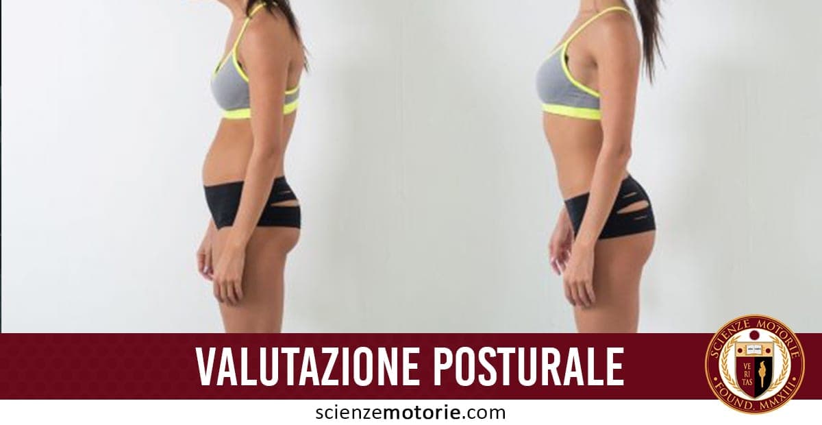 Confronto posturale tra due figure in abbigliamento sportivo su sfondo neutro, evidenziata differenza nella postura, logo Scienze Motorie.