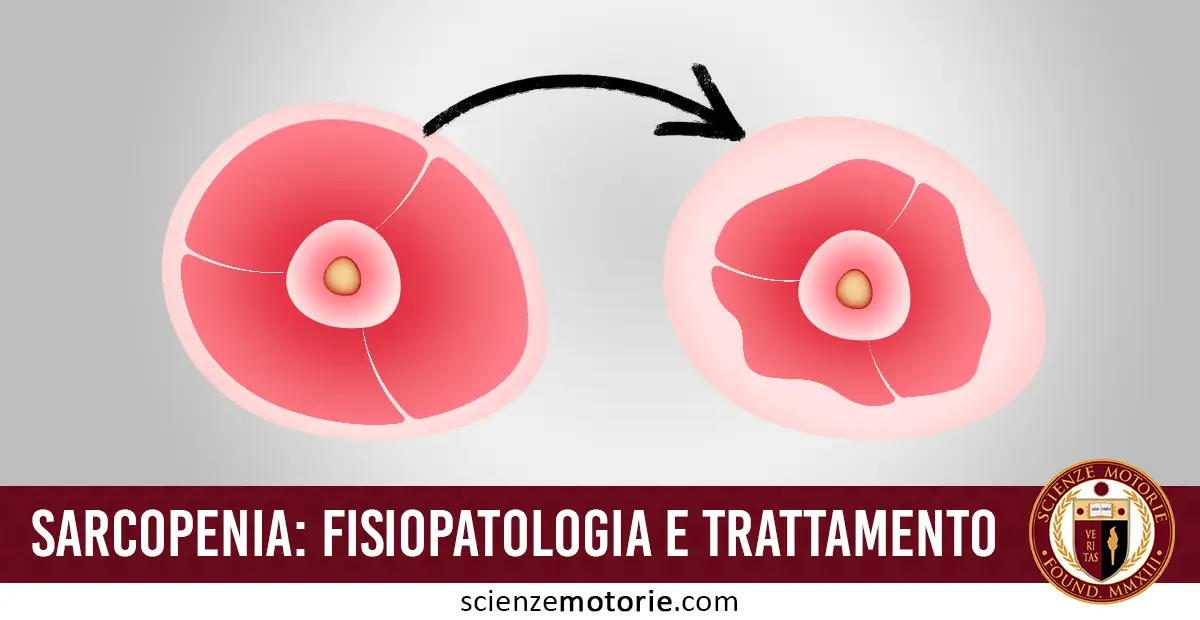 Illustrazione schematica della sarcopenia con confronto tra muscolo sano e muscolo atrofico, collegati da una freccia che indica perdita di massa muscolare.