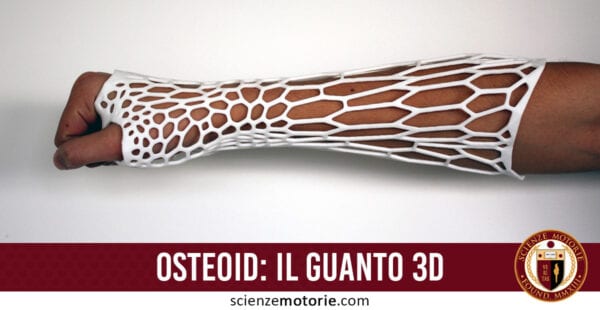 Osteoid il guanto 3D che manda in pensione il gesso