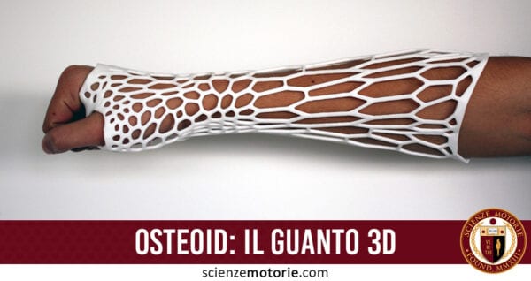 Osteoid il guanto 3D che manda in pensione il gesso