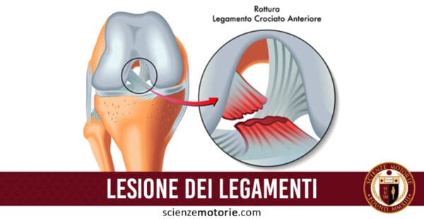 Lesione dei Legamenti