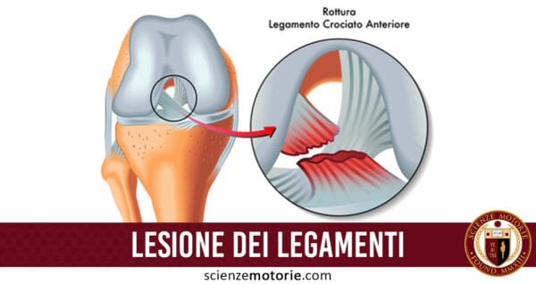 Lesione dei Legamenti