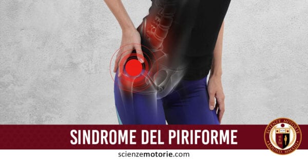 sindrome del piriforme