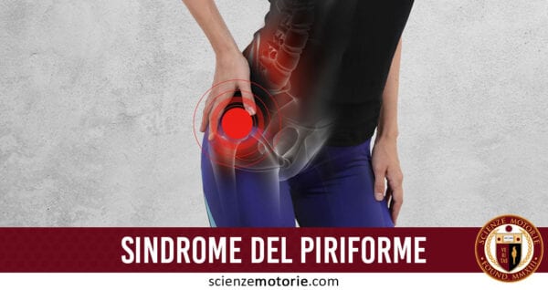 sindrome del piriforme