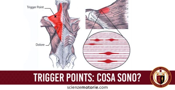 trigger points