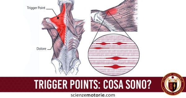 trigger points