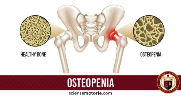 osteopenia