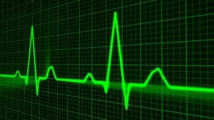 Electromap: analisi e mappatura di dati cardiaci complessi