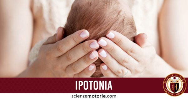 ipotonia