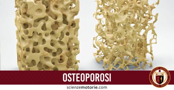 osteoporosi