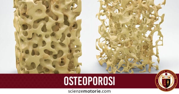 osteoporosi