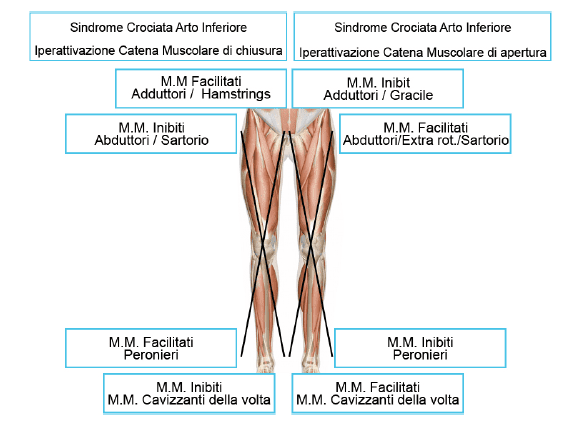 sindrome crociata