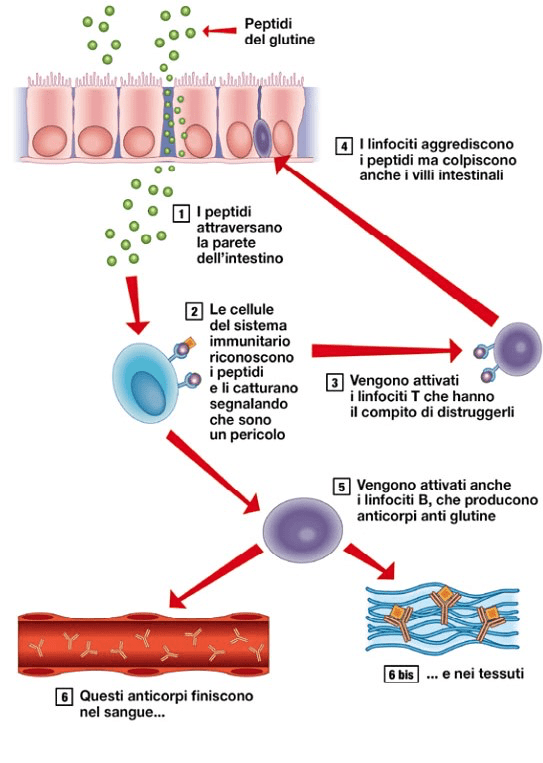 celiachia