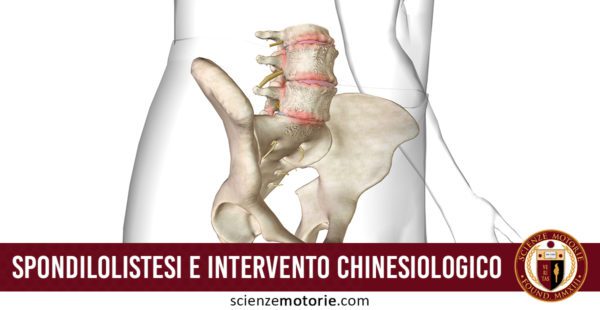 Spondilolistesi e intervento chinesiologico