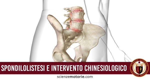 Spondilolistesi e intervento chinesiologico