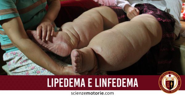 lipedema e linfedema