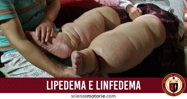 lipedema e linfedema