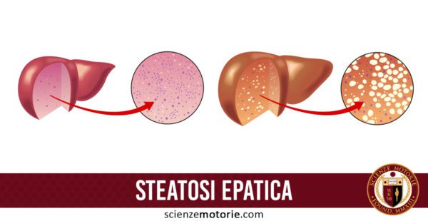 steatosi epatica