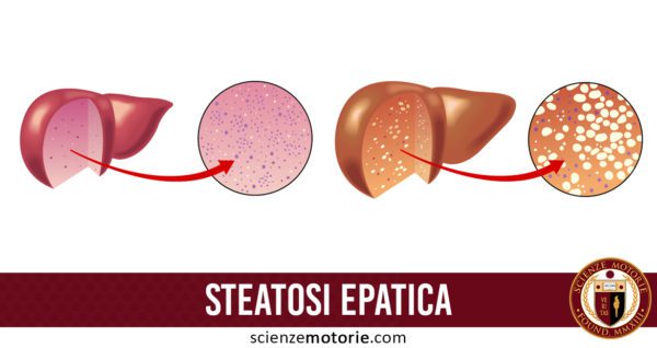 steatosi epatica