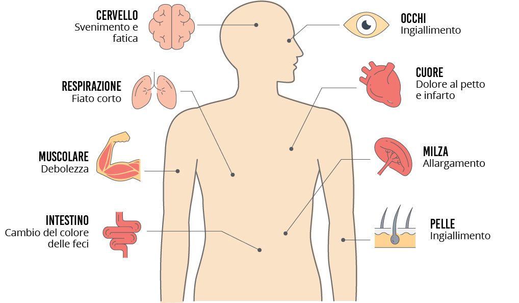 Sintomi Anemia