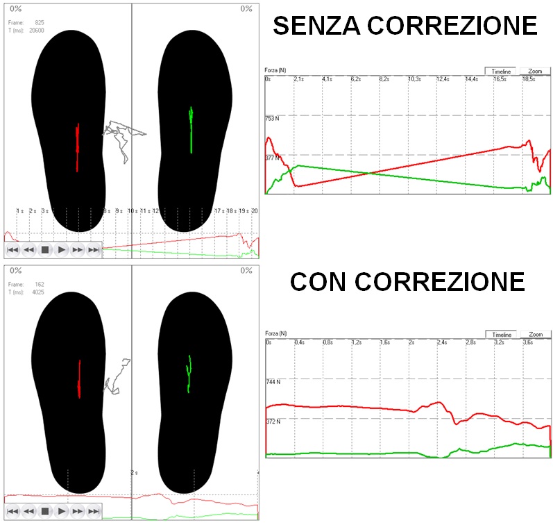 utilizzo non convenzionale pedane pressorie