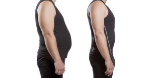 Obesità e diabete allenamento posturale