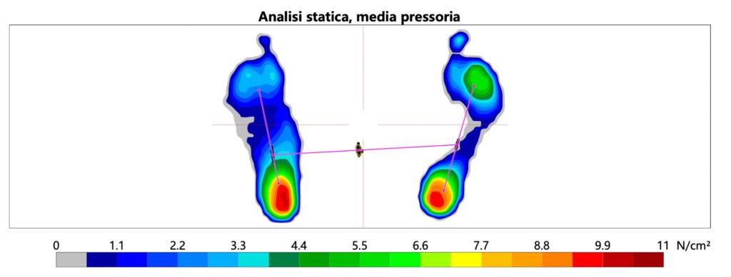 parametri analisi statica